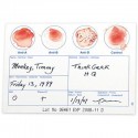 Blood Typing Test Kit
